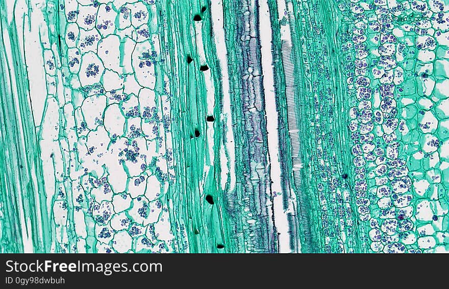 long section: Cucurbita stem magnification: 100x Bicollateral vascular bundles have two zones of phloem and two zones of cambium on either side of the central xylem with outer facing tissues more heavily developed. The sequence of tissues in the bicollateral vascular bundle is outer phloem, outer cambium, xylem, inner cambium and inner phloem with outer more heavily developed. Walls of xylem vessels have lignin free pits and lignin thickenings that form rings, spirals, networks and solid blocks. Phloem consists of large clear sieve tubes with pitted cell walls and sieve plates and small narrow green stained companion cells. Many sieve plates have deposits of a mucoid p-protein that forms as part of the trauma response in injured phloem. Between the xylem and phloem are a few regularly arranged layers of elongated cambium cells. long section: Cucurbita stem magnification: 100x Bicollateral vascular bundles have two zones of phloem and two zones of cambium on either side of the central xylem with outer facing tissues more heavily developed. The sequence of tissues in the bicollateral vascular bundle is outer phloem, outer cambium, xylem, inner cambium and inner phloem with outer more heavily developed. Walls of xylem vessels have lignin free pits and lignin thickenings that form rings, spirals, networks and solid blocks. Phloem consists of large clear sieve tubes with pitted cell walls and sieve plates and small narrow green stained companion cells. Many sieve plates have deposits of a mucoid p-protein that forms as part of the trauma response in injured phloem. Between the xylem and phloem are a few regularly arranged layers of elongated cambium cells.