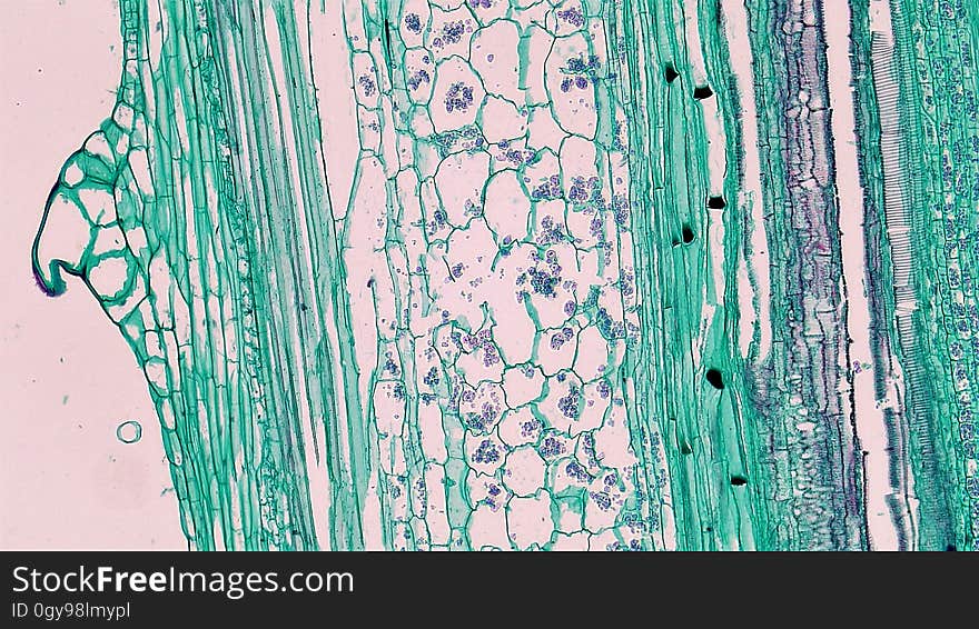 long section: Cucurbita stem magnification: 100x The epidermis is usually single layered with an outer cuticle and multicellular trichomes. The cortex consists of a conspicuous hypodermis of parenchyma cells with collections of collenchyma cells at the stem ridges. The deepest layer of the cortex is marked by a starch sheath &#x28;large barrel-shaped cells contain starch granules&#x29;. Bicollateral vascular bundles have two zones of phloem and two zones of cambium on either side of the central xylem with outer facing tissues more heavily developed. The sequence of tissues in the bicollateral vascular bundle is outer phloem, outer cambium, xylem, inner cambium and inner phloem with outer more heavily developed. Walls of xylem vessels have lignin free pits and lignin thickenings that form rings, spirals, networks and solid blocks. Phloem consists of large clear sieve tubes with pitted cell walls and sieve plates and small narrow green stained companion cells. Many sieve plates have deposits of a mucoid p-protein that forms as part of the trauma response in injured phloem. Between the xylem and phloem are a few regularly arranged layers of elongated cambium cells. long section: Cucurbita stem magnification: 100x The epidermis is usually single layered with an outer cuticle and multicellular trichomes. The cortex consists of a conspicuous hypodermis of parenchyma cells with collections of collenchyma cells at the stem ridges. The deepest layer of the cortex is marked by a starch sheath &#x28;large barrel-shaped cells contain starch granules&#x29;. Bicollateral vascular bundles have two zones of phloem and two zones of cambium on either side of the central xylem with outer facing tissues more heavily developed. The sequence of tissues in the bicollateral vascular bundle is outer phloem, outer cambium, xylem, inner cambium and inner phloem with outer more heavily developed. Walls of xylem vessels have lignin free pits and lignin thickenings that form rings, spirals, networks and solid blocks. Phloem consists of large clear sieve tubes with pitted cell walls and sieve plates and small narrow green stained companion cells. Many sieve plates have deposits of a mucoid p-protein that forms as part of the trauma response in injured phloem. Between the xylem and phloem are a few regularly arranged layers of elongated cambium cells.