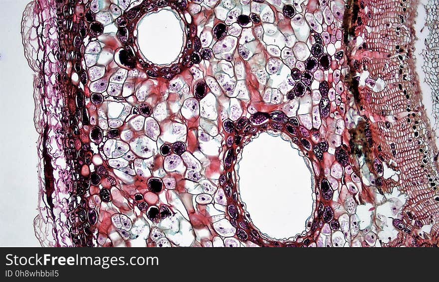 cross section: Pinus stem magnification: 100x During the first year of growth the cutinized epidermis is replaced by protective growth of cork rich periderm. The outer periderm consists of layers of cork cells, the phellem, which produces waterproofing suberin. Cork cells are dead at maturity. Deep to the phellem is a living layer of cork cambium or phellogen and beneath that, layers of cork parenchyma or phelloderm. Many cells in the periderm contain dark staining tannins. The cortex is divided into a thin outer hypodermis of lignified sclerenchyma cells and thicker inner cortex of thin walled parenchyma cells containing chloroplasts. Large resin ducts are surrounded by secretory parenchyma that produces resins and turpentines. Some cells enlarge into dark staining tyloses. Both endoderm and pericycle are inconspicuous. The vascular cylinder or stele in young stems consists of a ring of vascular bundles interspaced with medullary rays of parenchyma cells. Seasonal activity of the cambium replaces the isolated vascular bundles with well-defined annual rings of secondary phloem and xylem. Xylem is endarch with protoxylem found towards center of the stem and younger metaxylem towards the periphery of the stem. Protoxylem consists of annular and spiral tracheids with only tracheids found in metaxylem. True xylem vessels are lacking. Because of the greater production of xylem, the vascular cylinder is dominated by radially arranged rays of secondary xylem interspaced with medullary rays of parenchyma cells. Conspicuous resin ducts are present throughout the xylem. Phloem is endarch but annual growth the of stem makes it difficult to distinguish between older protophloem to the periphery and younger metapholem towards center of the stem. Phloem lacks companion cells, consisting entirely of sieve tubes and phloem parenchyma. Medullary rays in the secondary phloem include protein rich albuminous cells. A well-defined pith of parenchyma cells is interrupted by a few large resin ducts. cross section: Pinus stem magnification: 100x During the first year of growth the cutinized epidermis is replaced by protective growth of cork rich periderm. The outer periderm consists of layers of cork cells, the phellem, which produces waterproofing suberin. Cork cells are dead at maturity. Deep to the phellem is a living layer of cork cambium or phellogen and beneath that, layers of cork parenchyma or phelloderm. Many cells in the periderm contain dark staining tannins. The cortex is divided into a thin outer hypodermis of lignified sclerenchyma cells and thicker inner cortex of thin walled parenchyma cells containing chloroplasts. Large resin ducts are surrounded by secretory parenchyma that produces resins and turpentines. Some cells enlarge into dark staining tyloses. Both endoderm and pericycle are inconspicuous. The vascular cylinder or stele in young stems consists of a ring of vascular bundles interspaced with medullary rays of parenchyma cells. Seasonal activity of the cambium replaces the isolated vascular bundles with well-defined annual rings of secondary phloem and xylem. Xylem is endarch with protoxylem found towards center of the stem and younger metaxylem towards the periphery of the stem. Protoxylem consists of annular and spiral tracheids with only tracheids found in metaxylem. True xylem vessels are lacking. Because of the greater production of xylem, the vascular cylinder is dominated by radially arranged rays of secondary xylem interspaced with medullary rays of parenchyma cells. Conspicuous resin ducts are present throughout the xylem. Phloem is endarch but annual growth the of stem makes it difficult to distinguish between older protophloem to the periphery and younger metapholem towards center of the stem. Phloem lacks companion cells, consisting entirely of sieve tubes and phloem parenchyma. Medullary rays in the secondary phloem include protein rich albuminous cells. A well-defined pith of parenchyma cells is interrupted by a few large resin ducts.