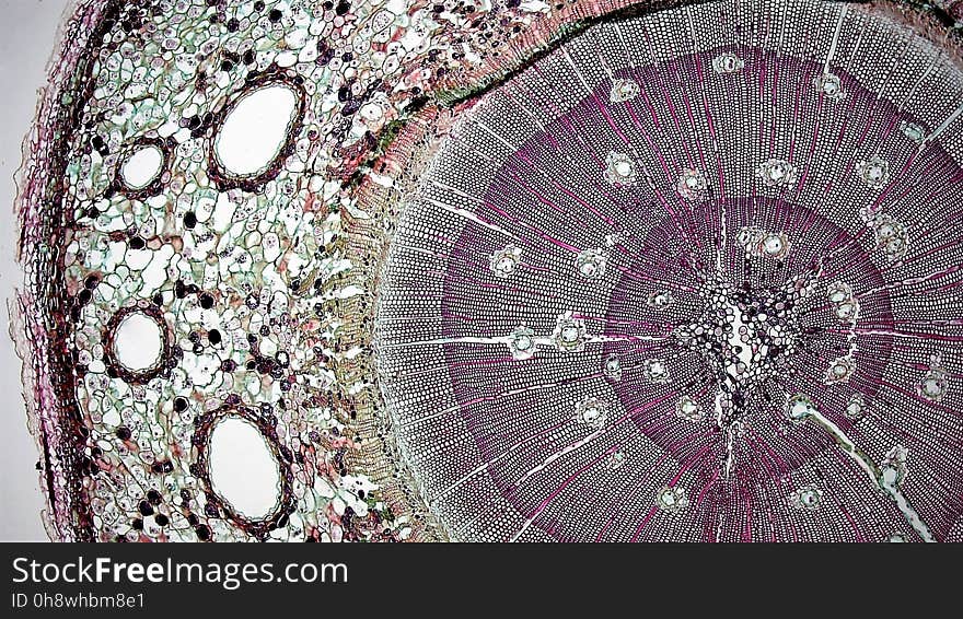 cross section: Pinus stem magnification: 40x During the first year of growth the cutinized epidermis is replaced by protective growth of cork rich periderm. The outer periderm consists of layers of cork cells, the phellem, which produces waterproofing suberin. Cork cells are dead at maturity. Deep to the phellem is a living layer of cork cambium or phellogen and beneath that, layers of cork parenchyma or phelloderm. Many cells in the periderm contain dark staining tannins. The cortex is divided into a thin outer hypodermis of lignified sclerenchyma cells and thicker inner cortex of thin walled parenchyma cells containing chloroplasts. Large resin ducts are surrounded by secretory parenchyma that produces resins and turpentines. Some cells enlarge into dark staining tyloses. Both endoderm and pericycle are inconspicuous. The vascular cylinder or stele in young stems consists of a ring of vascular bundles interspaced with medullary rays of parenchyma cells. Seasonal activity of the cambium replaces the isolated vascular bundles with well-defined annual rings of secondary phloem and xylem. Xylem is endarch with protoxylem found towards center of the stem and younger metaxylem towards the periphery of the stem. Protoxylem consists of annular and spiral tracheids with only tracheids found in metaxylem. True xylem vessels are lacking. Because of the greater production of xylem, the vascular cylinder is dominated by radially arranged rays of secondary xylem interspaced with medullary rays of parenchyma cells. Conspicuous resin ducts are present throughout the xylem. Phloem is endarch but annual growth the of stem makes it difficult to distinguish between older protophloem to the periphery and younger metapholem towards center of the stem. Phloem lacks companion cells, consisting entirely of sieve tubes and phloem parenchyma. Medullary rays in the secondary phloem include protein rich albuminous cells. A well-defined pith of parenchyma cells is interrupted by a few large resin ducts. cross section: Pinus stem magnification: 40x During the first year of growth the cutinized epidermis is replaced by protective growth of cork rich periderm. The outer periderm consists of layers of cork cells, the phellem, which produces waterproofing suberin. Cork cells are dead at maturity. Deep to the phellem is a living layer of cork cambium or phellogen and beneath that, layers of cork parenchyma or phelloderm. Many cells in the periderm contain dark staining tannins. The cortex is divided into a thin outer hypodermis of lignified sclerenchyma cells and thicker inner cortex of thin walled parenchyma cells containing chloroplasts. Large resin ducts are surrounded by secretory parenchyma that produces resins and turpentines. Some cells enlarge into dark staining tyloses. Both endoderm and pericycle are inconspicuous. The vascular cylinder or stele in young stems consists of a ring of vascular bundles interspaced with medullary rays of parenchyma cells. Seasonal activity of the cambium replaces the isolated vascular bundles with well-defined annual rings of secondary phloem and xylem. Xylem is endarch with protoxylem found towards center of the stem and younger metaxylem towards the periphery of the stem. Protoxylem consists of annular and spiral tracheids with only tracheids found in metaxylem. True xylem vessels are lacking. Because of the greater production of xylem, the vascular cylinder is dominated by radially arranged rays of secondary xylem interspaced with medullary rays of parenchyma cells. Conspicuous resin ducts are present throughout the xylem. Phloem is endarch but annual growth the of stem makes it difficult to distinguish between older protophloem to the periphery and younger metapholem towards center of the stem. Phloem lacks companion cells, consisting entirely of sieve tubes and phloem parenchyma. Medullary rays in the secondary phloem include protein rich albuminous cells. A well-defined pith of parenchyma cells is interrupted by a few large resin ducts.