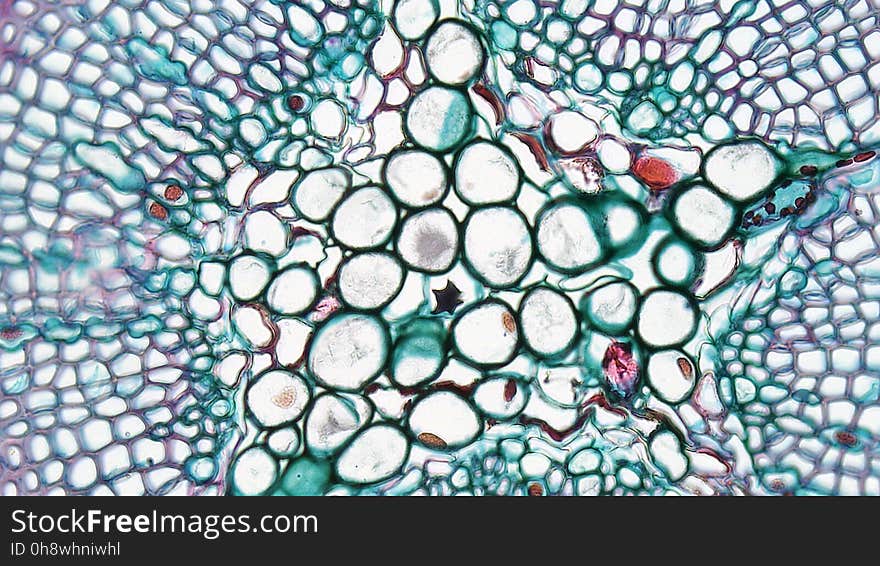 cross section: Pinus stem magnification: 400x During the first year of growth the cutinized epidermis is replaced by protective growth of cork rich periderm. The outer periderm consists of layers of cork cells, the phellem, which produces waterproofing suberin. Cork cells are dead at maturity. Deep to the phellem is a living layer of cork cambium or phellogen and beneath that, layers of cork parenchyma or phelloderm. Many cells in the periderm contain dark staining tannins. The cortex is divided into a thin outer hypodermis of lignified sclerenchyma cells and thicker inner cortex of thin walled parenchyma cells containing chloroplasts. Large resin ducts are surrounded by secretory parenchyma that produces resins and turpentines. Some cells enlarge into dark staining tyloses. Both endoderm and pericycle are inconspicuous. The vascular cylinder or stele in young stems consists of a ring of vascular bundles interspaced with medullary rays of parenchyma cells. Seasonal activity of the cambium replaces the isolated vascular bundles with well-defined annual rings of secondary phloem and xylem. Xylem is endarch with protoxylem found towards center of the stem and younger metaxylem towards the periphery of the stem. Protoxylem consists of annular and spiral tracheids with only tracheids found in metaxylem. True xylem vessels are lacking. Because of the greater production of xylem, the vascular cylinder is dominated by radially arranged rays of secondary xylem interspaced with medullary rays of parenchyma cells. Conspicuous resin ducts are present throughout the xylem. Phloem is endarch but annual growth the of stem makes it difficult to distinguish between older protophloem to the periphery and younger metapholem towards center of the stem. Phloem lacks companion cells, consisting entirely of sieve tubes and phloem parenchyma. Medullary rays in the secondary phloem include protein rich albuminous cells. A well-defined pith of parenchyma cells is interrupted by a few large resin ducts. cross section: Pinus stem magnification: 400x During the first year of growth the cutinized epidermis is replaced by protective growth of cork rich periderm. The outer periderm consists of layers of cork cells, the phellem, which produces waterproofing suberin. Cork cells are dead at maturity. Deep to the phellem is a living layer of cork cambium or phellogen and beneath that, layers of cork parenchyma or phelloderm. Many cells in the periderm contain dark staining tannins. The cortex is divided into a thin outer hypodermis of lignified sclerenchyma cells and thicker inner cortex of thin walled parenchyma cells containing chloroplasts. Large resin ducts are surrounded by secretory parenchyma that produces resins and turpentines. Some cells enlarge into dark staining tyloses. Both endoderm and pericycle are inconspicuous. The vascular cylinder or stele in young stems consists of a ring of vascular bundles interspaced with medullary rays of parenchyma cells. Seasonal activity of the cambium replaces the isolated vascular bundles with well-defined annual rings of secondary phloem and xylem. Xylem is endarch with protoxylem found towards center of the stem and younger metaxylem towards the periphery of the stem. Protoxylem consists of annular and spiral tracheids with only tracheids found in metaxylem. True xylem vessels are lacking. Because of the greater production of xylem, the vascular cylinder is dominated by radially arranged rays of secondary xylem interspaced with medullary rays of parenchyma cells. Conspicuous resin ducts are present throughout the xylem. Phloem is endarch but annual growth the of stem makes it difficult to distinguish between older protophloem to the periphery and younger metapholem towards center of the stem. Phloem lacks companion cells, consisting entirely of sieve tubes and phloem parenchyma. Medullary rays in the secondary phloem include protein rich albuminous cells. A well-defined pith of parenchyma cells is interrupted by a few large resin ducts.