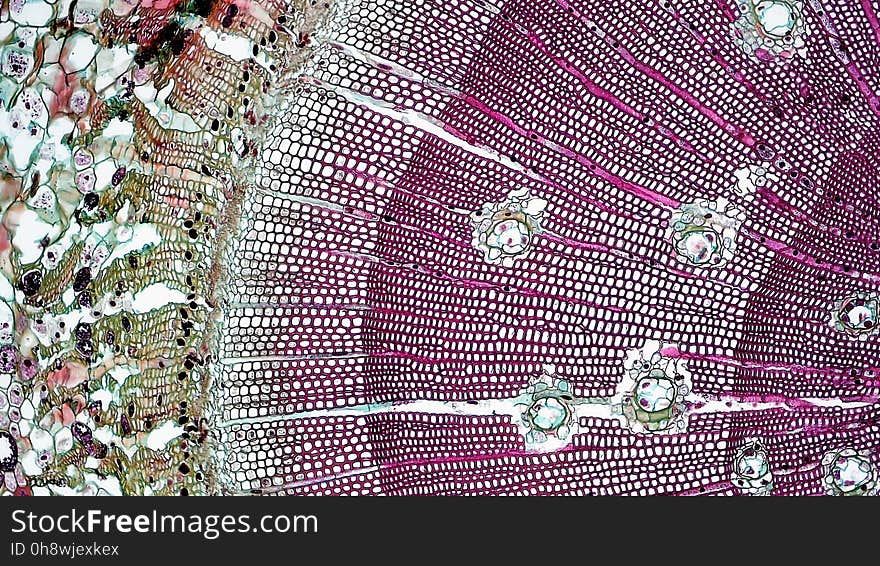 cross section: Pinus stem magnification: 100x During the first year of growth the cutinized epidermis is replaced by protective growth of cork rich periderm. The outer periderm consists of layers of cork cells, the phellem, which produces waterproofing suberin. Cork cells are dead at maturity. Deep to the phellem is a living layer of cork cambium or phellogen and beneath that, layers of cork parenchyma or phelloderm. Many cells in the periderm contain dark staining tannins. The cortex is divided into a thin outer hypodermis of lignified sclerenchyma cells and thicker inner cortex of thin walled parenchyma cells containing chloroplasts. Large resin ducts are surrounded by secretory parenchyma that produces resins and turpentines. Some cells enlarge into dark staining tyloses. Both endoderm and pericycle are inconspicuous. The vascular cylinder or stele in young stems consists of a ring of vascular bundles interspaced with medullary rays of parenchyma cells. Seasonal activity of the cambium replaces the isolated vascular bundles with well-defined annual rings of secondary phloem and xylem. Xylem is endarch with protoxylem found towards center of the stem and younger metaxylem towards the periphery of the stem. Protoxylem consists of annular and spiral tracheids with only tracheids found in metaxylem. True xylem vessels are lacking. Because of the greater production of xylem, the vascular cylinder is dominated by radially arranged rays of secondary xylem interspaced with medullary rays of parenchyma cells. Conspicuous resin ducts are present throughout the xylem. Phloem is endarch but annual growth the of stem makes it difficult to distinguish between older protophloem to the periphery and younger metapholem towards center of the stem. Phloem lacks companion cells, consisting entirely of sieve tubes and phloem parenchyma. Medullary rays in the secondary phloem include protein rich albuminous cells. A well-defined pith of parenchyma cells is interrupted by a few large resin ducts. cross section: Pinus stem magnification: 100x During the first year of growth the cutinized epidermis is replaced by protective growth of cork rich periderm. The outer periderm consists of layers of cork cells, the phellem, which produces waterproofing suberin. Cork cells are dead at maturity. Deep to the phellem is a living layer of cork cambium or phellogen and beneath that, layers of cork parenchyma or phelloderm. Many cells in the periderm contain dark staining tannins. The cortex is divided into a thin outer hypodermis of lignified sclerenchyma cells and thicker inner cortex of thin walled parenchyma cells containing chloroplasts. Large resin ducts are surrounded by secretory parenchyma that produces resins and turpentines. Some cells enlarge into dark staining tyloses. Both endoderm and pericycle are inconspicuous. The vascular cylinder or stele in young stems consists of a ring of vascular bundles interspaced with medullary rays of parenchyma cells. Seasonal activity of the cambium replaces the isolated vascular bundles with well-defined annual rings of secondary phloem and xylem. Xylem is endarch with protoxylem found towards center of the stem and younger metaxylem towards the periphery of the stem. Protoxylem consists of annular and spiral tracheids with only tracheids found in metaxylem. True xylem vessels are lacking. Because of the greater production of xylem, the vascular cylinder is dominated by radially arranged rays of secondary xylem interspaced with medullary rays of parenchyma cells. Conspicuous resin ducts are present throughout the xylem. Phloem is endarch but annual growth the of stem makes it difficult to distinguish between older protophloem to the periphery and younger metapholem towards center of the stem. Phloem lacks companion cells, consisting entirely of sieve tubes and phloem parenchyma. Medullary rays in the secondary phloem include protein rich albuminous cells. A well-defined pith of parenchyma cells is interrupted by a few large resin ducts.