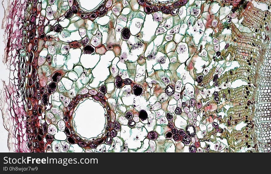 cross section: Pinus stem magnification: 100x During the first year of growth the cutinized epidermis is replaced by protective growth of cork rich periderm. The outer periderm consists of layers of cork cells, the phellem, which produces waterproofing suberin. Cork cells are dead at maturity. Deep to the phellem is a living layer of cork cambium or phellogen and beneath that, layers of cork parenchyma or phelloderm. Many cells in the periderm contain dark staining tannins. The cortex is divided into a thin outer hypodermis of lignified sclerenchyma cells and thicker inner cortex of thin walled parenchyma cells containing chloroplasts. Large resin ducts are surrounded by secretory parenchyma that produces resins and turpentines. Some cells enlarge into dark staining tyloses. Both endoderm and pericycle are inconspicuous. The vascular cylinder or stele in young stems consists of a ring of vascular bundles interspaced with medullary rays of parenchyma cells. Seasonal activity of the cambium replaces the isolated vascular bundles with well-defined annual rings of secondary phloem and xylem. Xylem is endarch with protoxylem found towards center of the stem and younger metaxylem towards the periphery of the stem. Protoxylem consists of annular and spiral tracheids with only tracheids found in metaxylem. True xylem vessels are lacking. Because of the greater production of xylem, the vascular cylinder is dominated by radially arranged rays of secondary xylem interspaced with medullary rays of parenchyma cells. Conspicuous resin ducts are present throughout the xylem. Phloem is endarch but annual growth the of stem makes it difficult to distinguish between older protophloem to the periphery and younger metapholem towards center of the stem. Phloem lacks companion cells, consisting entirely of sieve tubes and phloem parenchyma. Medullary rays in the secondary phloem include protein rich albuminous cells. A well-defined pith of parenchyma cells is interrupted by a few large resin ducts. cross section: Pinus stem magnification: 100x During the first year of growth the cutinized epidermis is replaced by protective growth of cork rich periderm. The outer periderm consists of layers of cork cells, the phellem, which produces waterproofing suberin. Cork cells are dead at maturity. Deep to the phellem is a living layer of cork cambium or phellogen and beneath that, layers of cork parenchyma or phelloderm. Many cells in the periderm contain dark staining tannins. The cortex is divided into a thin outer hypodermis of lignified sclerenchyma cells and thicker inner cortex of thin walled parenchyma cells containing chloroplasts. Large resin ducts are surrounded by secretory parenchyma that produces resins and turpentines. Some cells enlarge into dark staining tyloses. Both endoderm and pericycle are inconspicuous. The vascular cylinder or stele in young stems consists of a ring of vascular bundles interspaced with medullary rays of parenchyma cells. Seasonal activity of the cambium replaces the isolated vascular bundles with well-defined annual rings of secondary phloem and xylem. Xylem is endarch with protoxylem found towards center of the stem and younger metaxylem towards the periphery of the stem. Protoxylem consists of annular and spiral tracheids with only tracheids found in metaxylem. True xylem vessels are lacking. Because of the greater production of xylem, the vascular cylinder is dominated by radially arranged rays of secondary xylem interspaced with medullary rays of parenchyma cells. Conspicuous resin ducts are present throughout the xylem. Phloem is endarch but annual growth the of stem makes it difficult to distinguish between older protophloem to the periphery and younger metapholem towards center of the stem. Phloem lacks companion cells, consisting entirely of sieve tubes and phloem parenchyma. Medullary rays in the secondary phloem include protein rich albuminous cells. A well-defined pith of parenchyma cells is interrupted by a few large resin ducts.