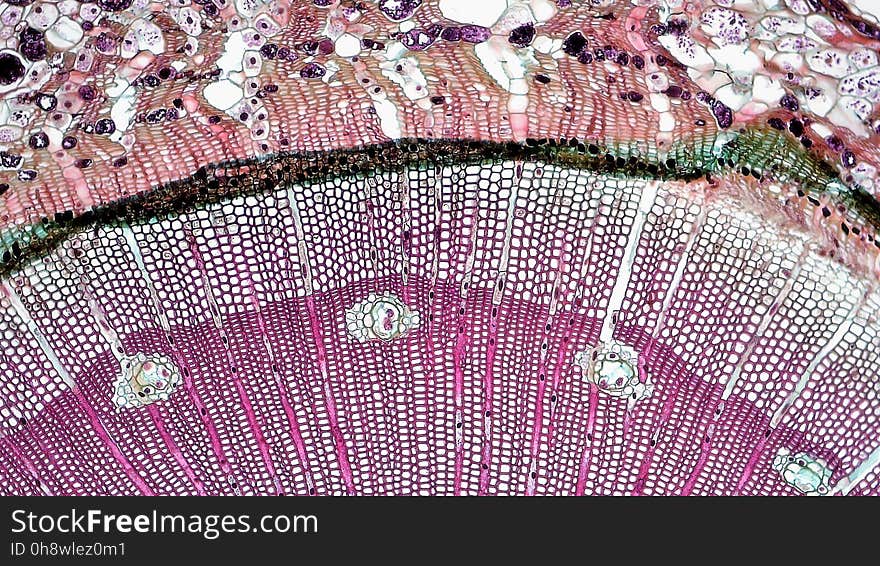 cross section: Pinus stem magnification: 100x During the first year of growth the cutinized epidermis is replaced by protective growth of cork rich periderm. The outer periderm consists of layers of cork cells, the phellem, which produces waterproofing suberin. Cork cells are dead at maturity. Deep to the phellem is a living layer of cork cambium or phellogen and beneath that, layers of cork parenchyma or phelloderm. Many cells in the periderm contain dark staining tannins. The cortex is divided into a thin outer hypodermis of lignified sclerenchyma cells and thicker inner cortex of thin walled parenchyma cells containing chloroplasts. Large resin ducts are surrounded by secretory parenchyma that produces resins and turpentines. Some cells enlarge into dark staining tyloses. Both endoderm and pericycle are inconspicuous. The vascular cylinder or stele in young stems consists of a ring of vascular bundles interspaced with medullary rays of parenchyma cells. Seasonal activity of the cambium replaces the isolated vascular bundles with well-defined annual rings of secondary phloem and xylem. Xylem is endarch with protoxylem found towards center of the stem and younger metaxylem towards the periphery of the stem. Protoxylem consists of annular and spiral tracheids with only tracheids found in metaxylem. True xylem vessels are lacking. Because of the greater production of xylem, the vascular cylinder is dominated by radially arranged rays of secondary xylem interspaced with medullary rays of parenchyma cells. Conspicuous resin ducts are present throughout the xylem. Phloem is endarch but annual growth the of stem makes it difficult to distinguish between older protophloem to the periphery and younger metapholem towards center of the stem. Phloem lacks companion cells, consisting entirely of sieve tubes and phloem parenchyma. Medullary rays in the secondary phloem include protein rich albuminous cells. A well-defined pith of parenchyma cells is interrupted by a few large resin ducts. cross section: Pinus stem magnification: 100x During the first year of growth the cutinized epidermis is replaced by protective growth of cork rich periderm. The outer periderm consists of layers of cork cells, the phellem, which produces waterproofing suberin. Cork cells are dead at maturity. Deep to the phellem is a living layer of cork cambium or phellogen and beneath that, layers of cork parenchyma or phelloderm. Many cells in the periderm contain dark staining tannins. The cortex is divided into a thin outer hypodermis of lignified sclerenchyma cells and thicker inner cortex of thin walled parenchyma cells containing chloroplasts. Large resin ducts are surrounded by secretory parenchyma that produces resins and turpentines. Some cells enlarge into dark staining tyloses. Both endoderm and pericycle are inconspicuous. The vascular cylinder or stele in young stems consists of a ring of vascular bundles interspaced with medullary rays of parenchyma cells. Seasonal activity of the cambium replaces the isolated vascular bundles with well-defined annual rings of secondary phloem and xylem. Xylem is endarch with protoxylem found towards center of the stem and younger metaxylem towards the periphery of the stem. Protoxylem consists of annular and spiral tracheids with only tracheids found in metaxylem. True xylem vessels are lacking. Because of the greater production of xylem, the vascular cylinder is dominated by radially arranged rays of secondary xylem interspaced with medullary rays of parenchyma cells. Conspicuous resin ducts are present throughout the xylem. Phloem is endarch but annual growth the of stem makes it difficult to distinguish between older protophloem to the periphery and younger metapholem towards center of the stem. Phloem lacks companion cells, consisting entirely of sieve tubes and phloem parenchyma. Medullary rays in the secondary phloem include protein rich albuminous cells. A well-defined pith of parenchyma cells is interrupted by a few large resin ducts.