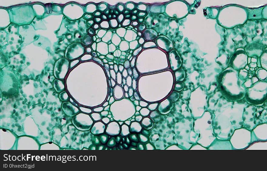 cross section:Zea leaf common name: corn magnification: 400x The iso-bilateral leaf of Zea is typical of most monocots. Both upper and lower epidermis are uniseriate and well cutinized. Within the upper, or adaxial, epidermis, large white bulliform cells shrink, allowing the leaf to roll during drought. Stomata are present on both surfaces with guard cells perched above small round substomatal chambers. As with most monocots the mesophyll is unspecialized, being composed of compactly arranged somewhat round chlorenchyma cells. Numerous small and occasionally large vascular bundles are arranged in parallel series along the length of the leaf. The vascular bundles are collateral and closed with xylem of vessels and tracheids towards the adaxial surface and phloem of sieve tubes and companion cells towards the abaxial surface. Cambium is not present. Within each bundle a xylem of two oval metaxylem and a single large protoxylem cavity can be seen. Each vascular bundle is wraped by a bundle sheath of thin walled parenchyma cells. Larger bundles are supported towards both surfaces by masses of sclerenchyma that interrupt the mesophyll to form a patchy hypodermis. cross section:Zea leaf common name: corn magnification: 400x The iso-bilateral leaf of Zea is typical of most monocots. Both upper and lower epidermis are uniseriate and well cutinized. Within the upper, or adaxial, epidermis, large white bulliform cells shrink, allowing the leaf to roll during drought. Stomata are present on both surfaces with guard cells perched above small round substomatal chambers. As with most monocots the mesophyll is unspecialized, being composed of compactly arranged somewhat round chlorenchyma cells. Numerous small and occasionally large vascular bundles are arranged in parallel series along the length of the leaf. The vascular bundles are collateral and closed with xylem of vessels and tracheids towards the adaxial surface and phloem of sieve tubes and companion cells towards the abaxial surface. Cambium is not present. Within each bundle a xylem of two oval metaxylem and a single large protoxylem cavity can be seen. Each vascular bundle is wraped by a bundle sheath of thin walled parenchyma cells. Larger bundles are supported towards both surfaces by masses of sclerenchyma that interrupt the mesophyll to form a patchy hypodermis.