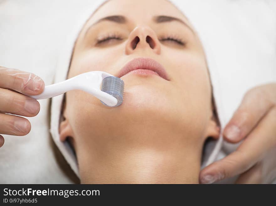 Roller Microneedle Mesotherapy. Portrait of a young woman. Roller Microneedle Mesotherapy. Portrait of a young woman