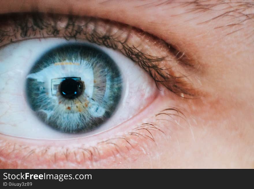 Person With Teal and Yellow Left Eye