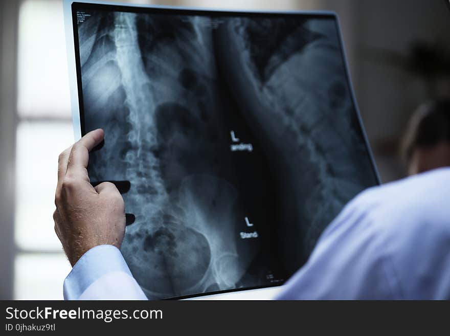 Person Holding X-ray Film