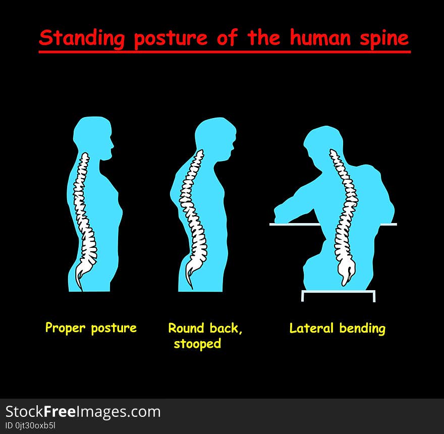 Standing posture of the blue human spine. Defects of the human spine. Correct alignment of human body in standing posture.