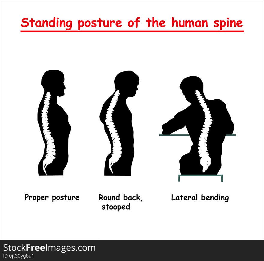 Standing posture of the black human spine. Defects of the human spine. Correct alignment of human body in standing posture.