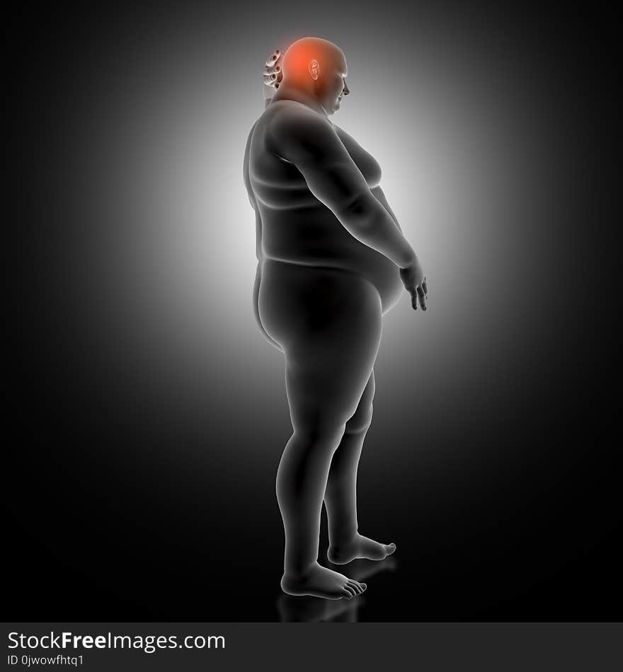 3D Medical Background With Overweight Man Holding Head In Pain