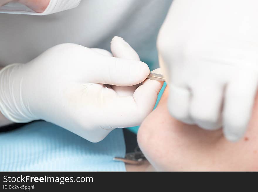 Hands In Gloves At The Surgeon During The Operation