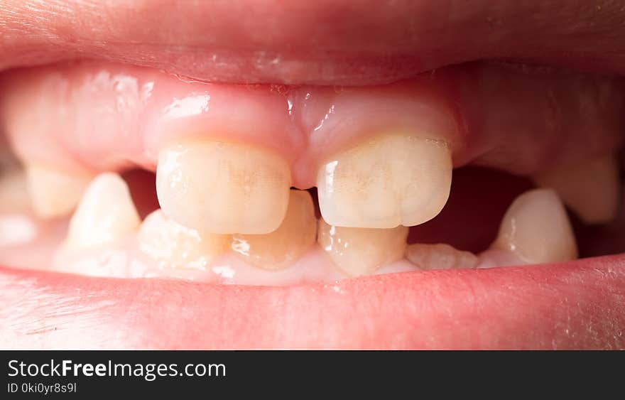 The teeth of the boy as a background. Macro