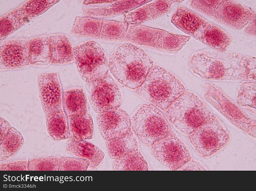 Root tip of Onion and Mitosis cell in the Root tip of Onion.