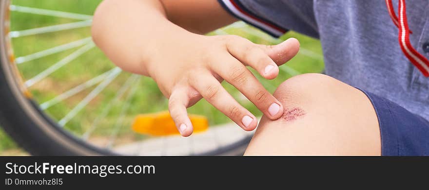 Boy With A Scraped Knee Outdoor. Wound On Boy Knee After Accident.