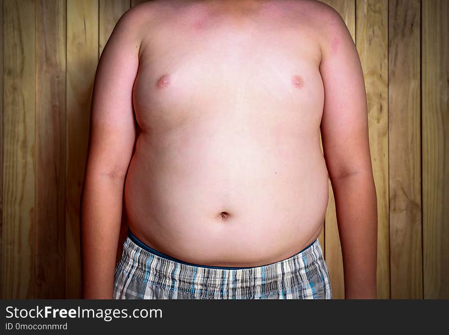 The size of stomach of children with overweight.