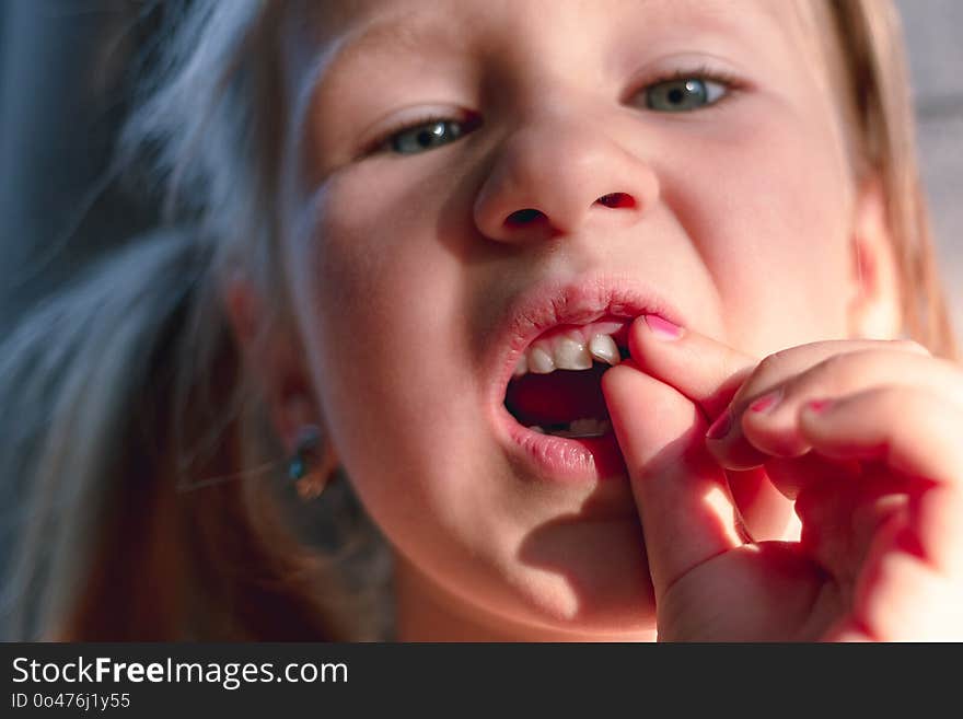 A little girl shows a wobbly baby tooth in her mouth.