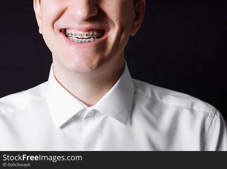 Portrait of a man of Caucasian appearance in orthodontic braces, metal brackets on his teeth in a white shirt on a black background. Dental concept, medicinal alignment of teeth orthodontist.