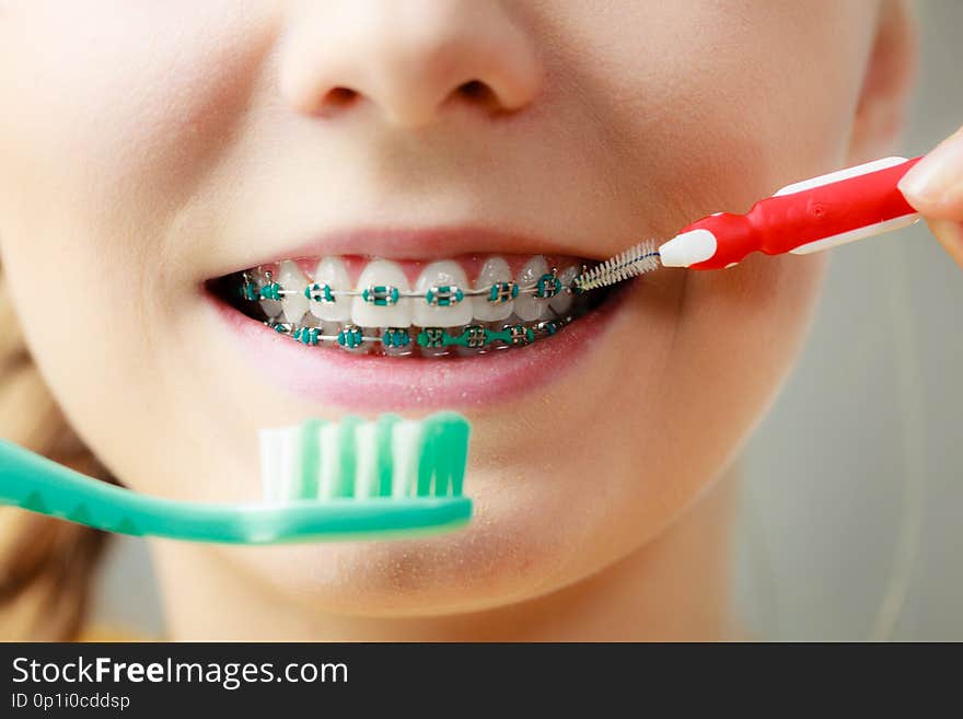Dentist and orthodontist concept. Young woman with blue braces cleaning and brushing teeth using two different brushes, little interdental brush and manual toothbrush. Dentist and orthodontist concept. Young woman with blue braces cleaning and brushing teeth using two different brushes, little interdental brush and manual toothbrush