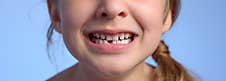 Teeth Of The Child. New Tooth Royalty Free Stock Image