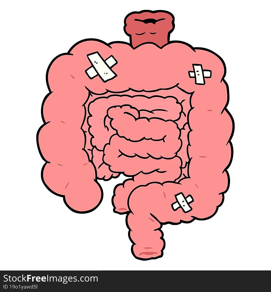 cartoon repaired intestines. cartoon repaired intestines