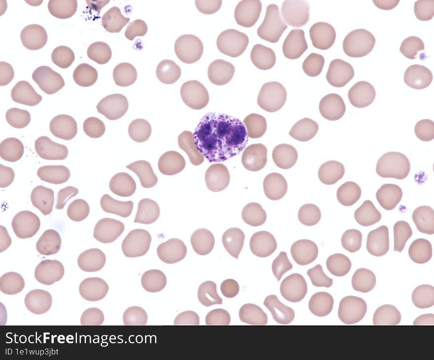 Normal basophil in peripheral blood. Wright x1000.