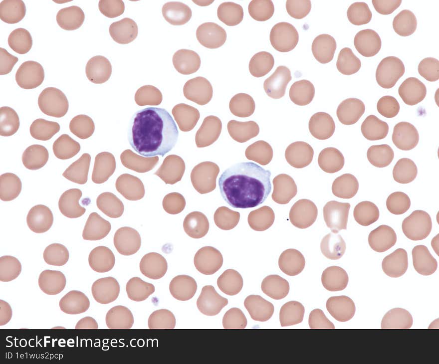 Normal lymphocytes in peripheral blood. Wright X1000.