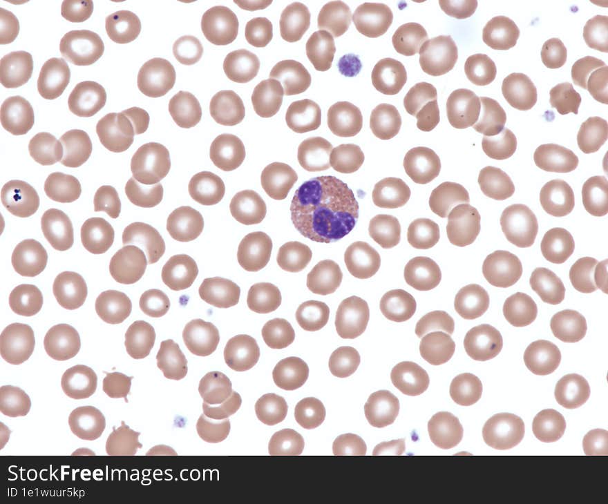 Normal eosinophil in peripheral blood. Wright X1000.