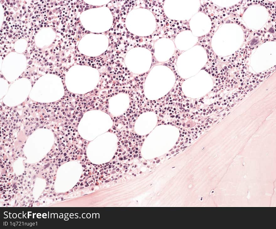 Normal bone marrow. Histology. HE x200.