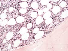 Normal Bone Marrow. Histology. HE X200. Stock Image