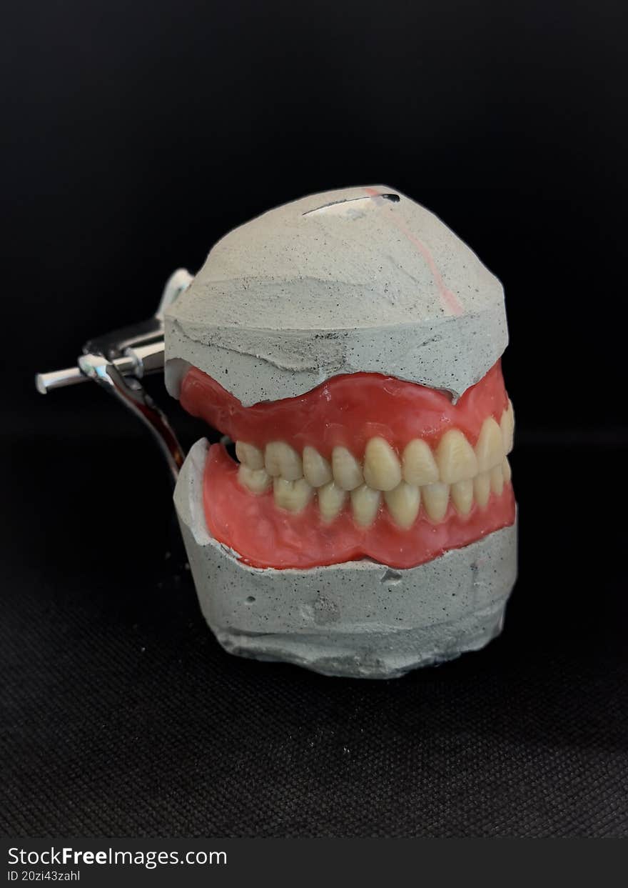Removable Vacuum Prosthesis Cast In An Occlusal Guard. Wax Compaction For Fitting In The Oral Cavity. Black Background